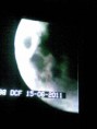 /album/zatmenie-mesiaca/fotka-video075-jpg/